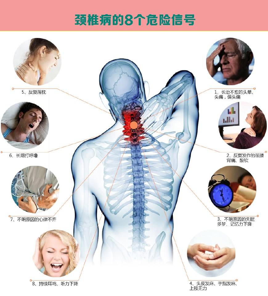 颈椎病自我锻炼很重要!